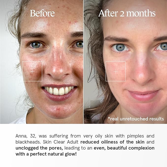 Skin Clear Adult