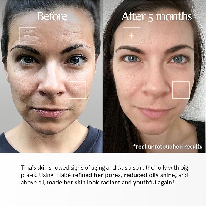 Aging Skin
